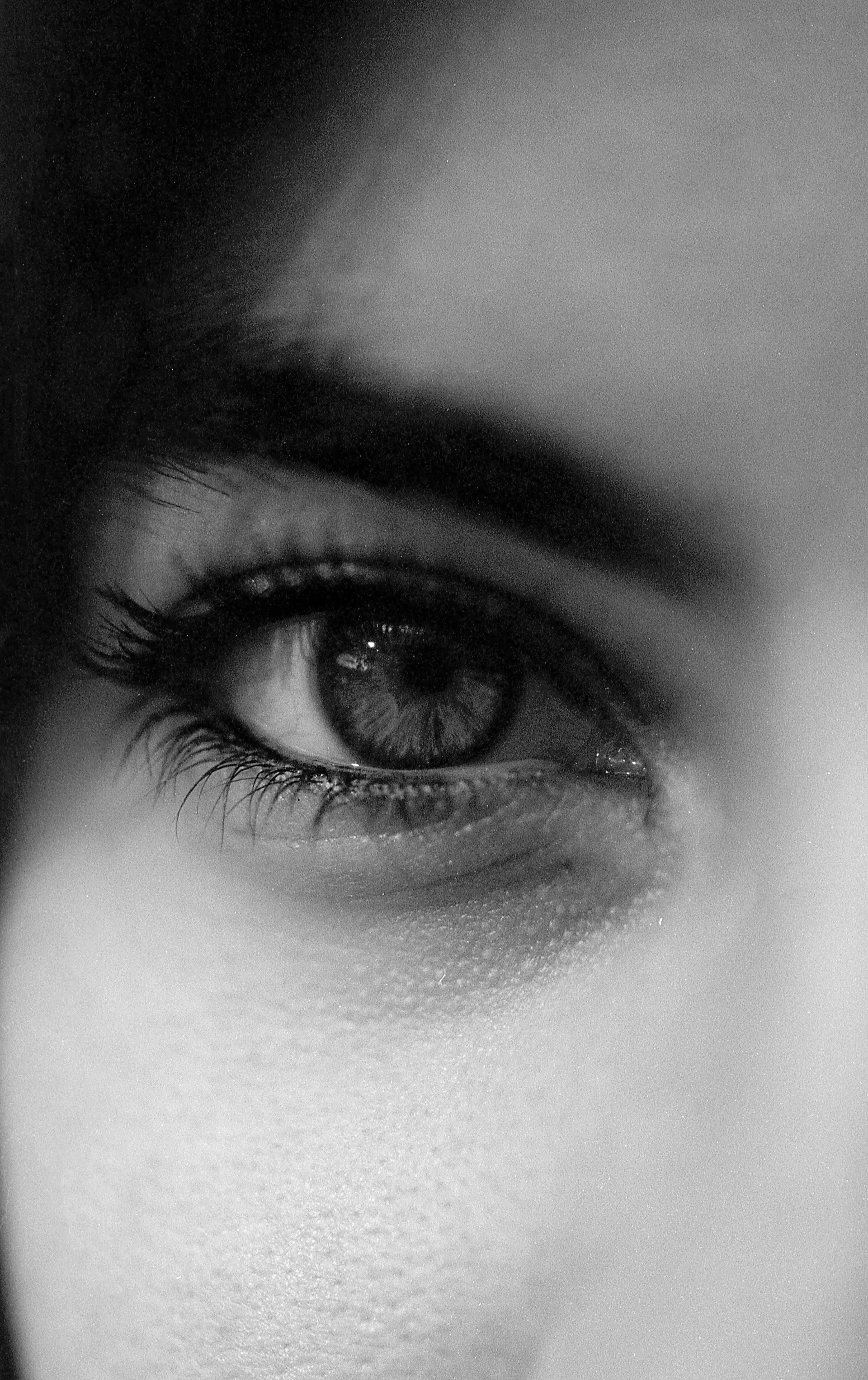 EMDR